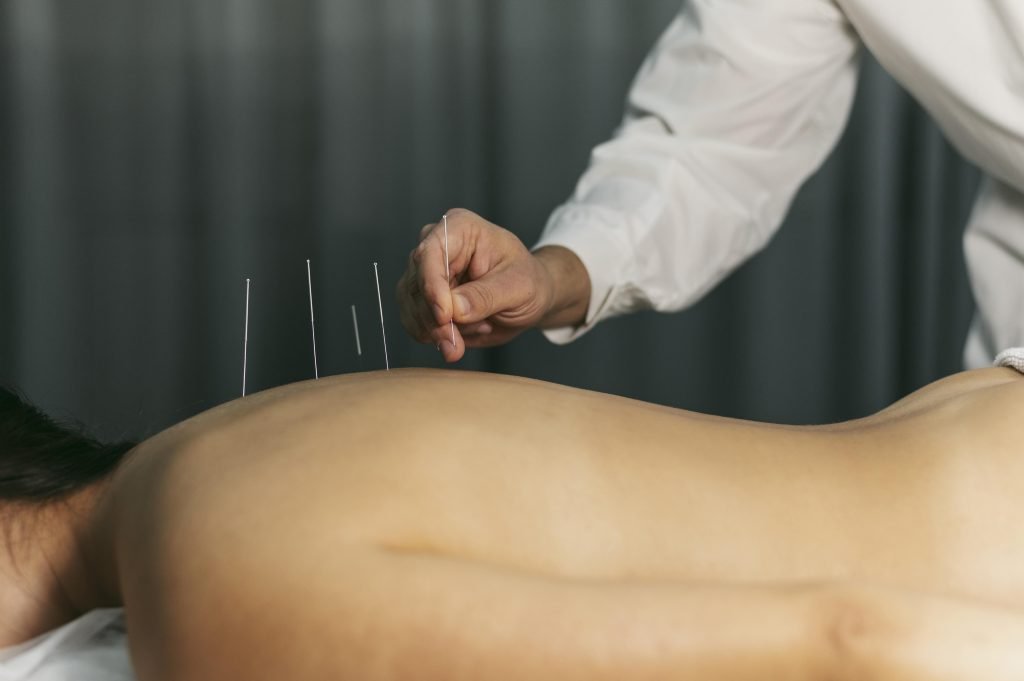 Acupuncturist in Heerenveen